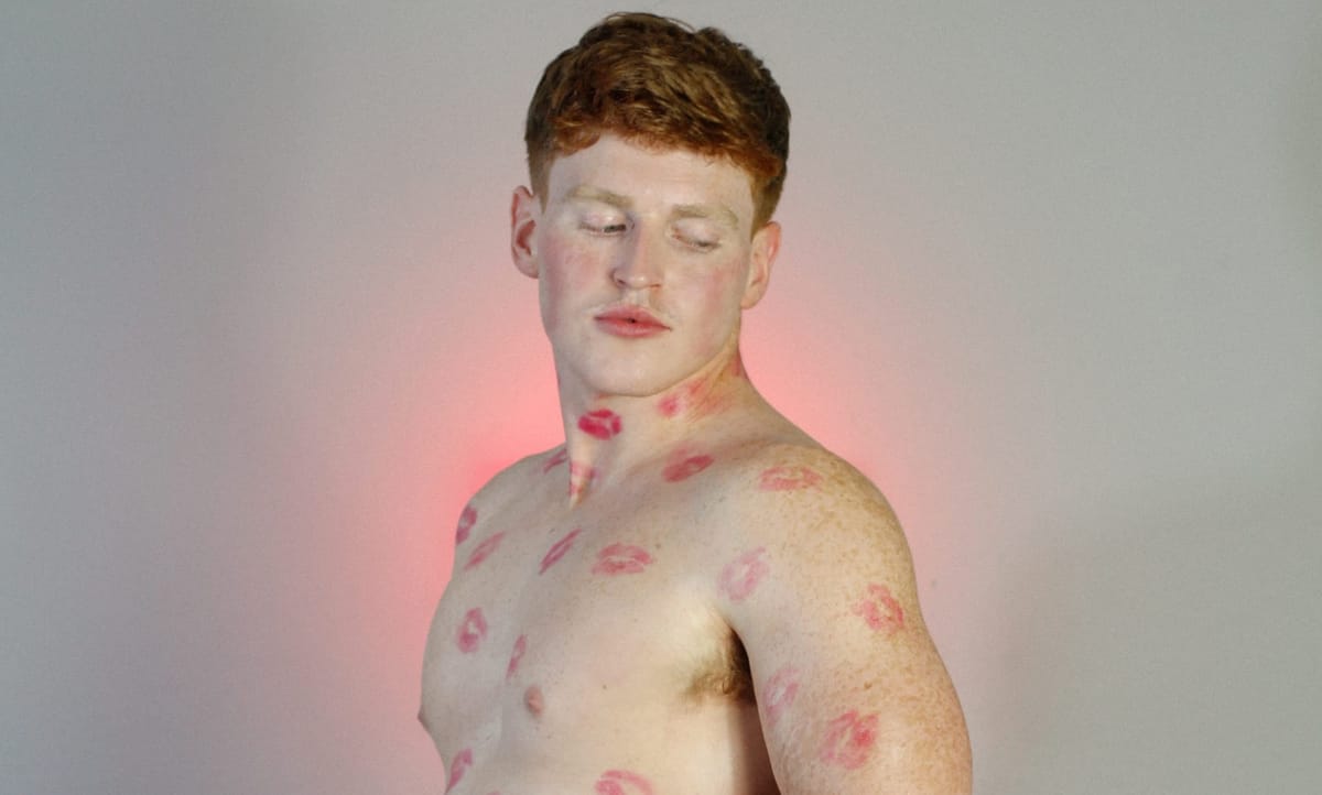 ManCrush: Freckle Fever